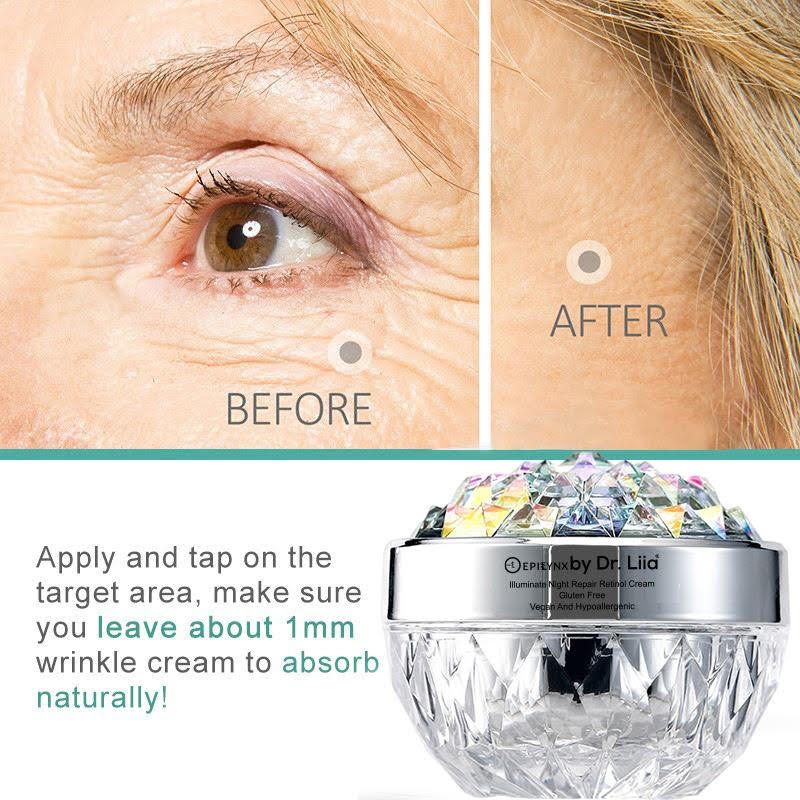 Anti-Aging Retinol Night Moisturizer – Hydrating, Vegan, Gluten-Free & Radiance-Boosting