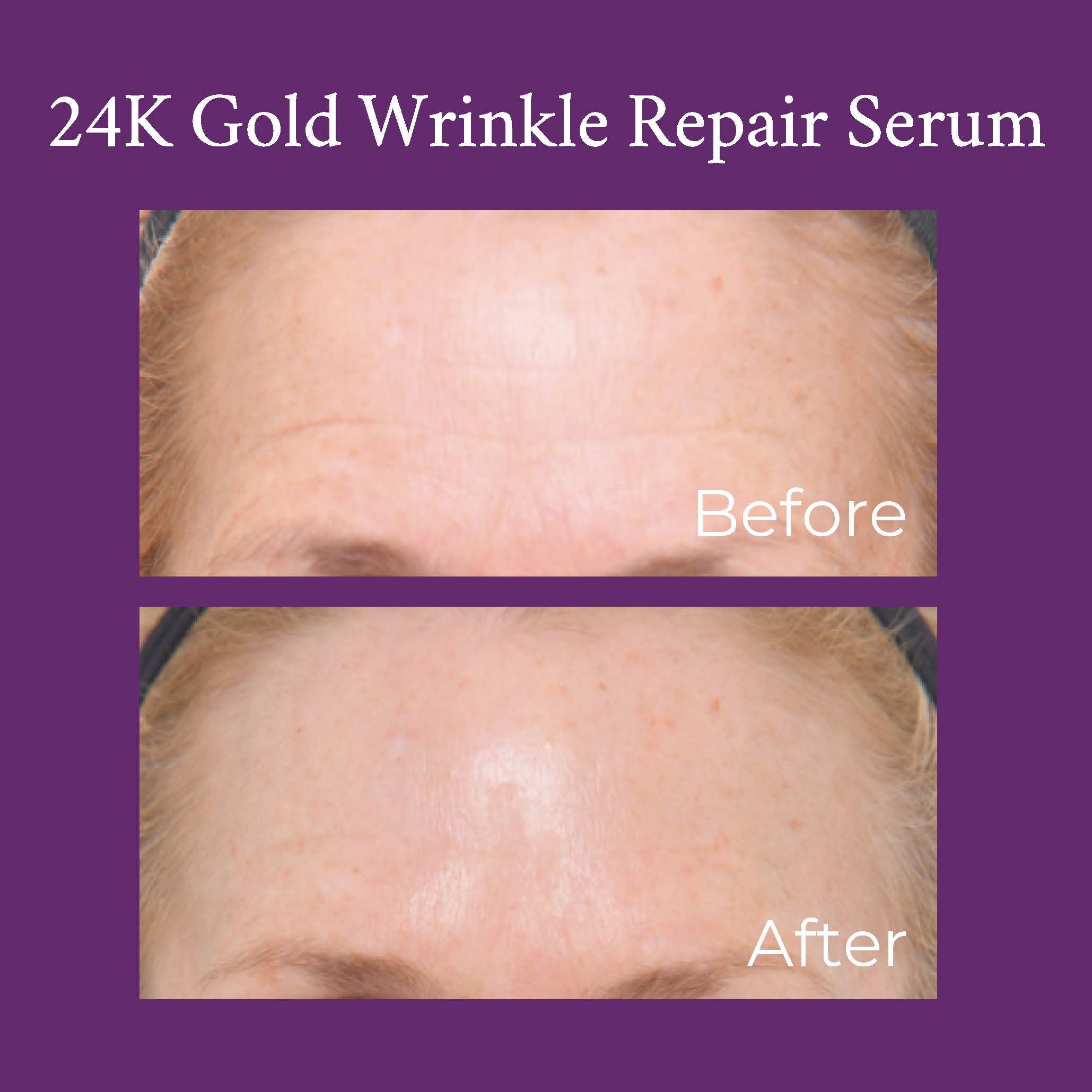 24K Gold Caviar Wrinkle Repair Serum