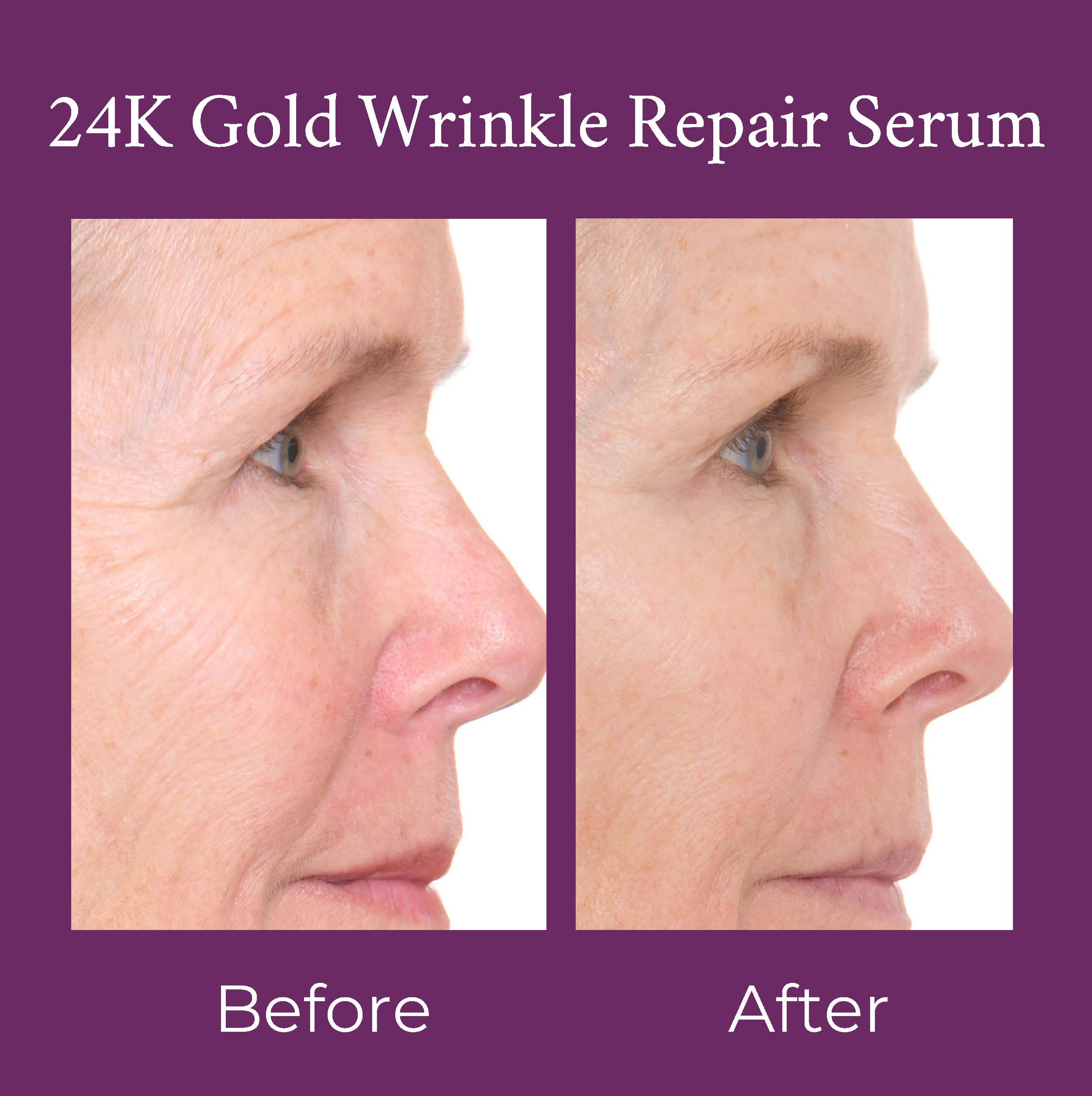 24K Gold Caviar Wrinkle Repair Serum